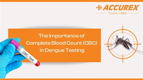 cbc in dengue|Dengue Fever: Prognostic Insights From a Complete .